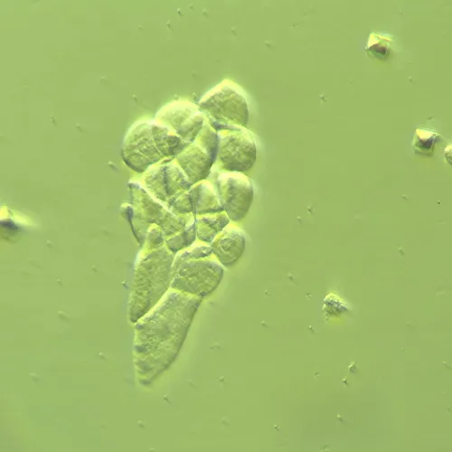 картинка Устройство за работа с контраст с модулация на Хофман MAGUS HCM360, с комплект обективи,  14