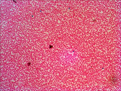 изображение Комплект подготвени проби Levenhuk N38 NG,  16