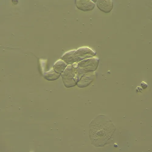 картинка Устройство за работа с контраст с модулация на Хофман MAGUS HCM360, с комплект обективи,  13